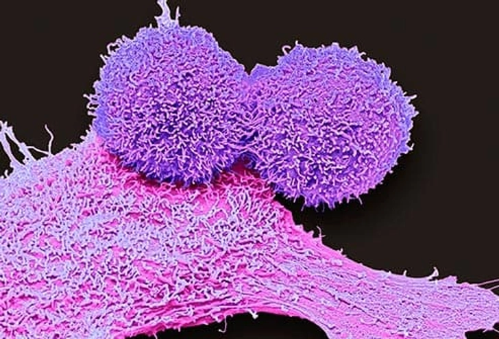 Breast cancer malignancy classification analysis visual.